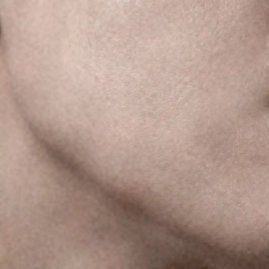Skin texture before treatment: uneven, dry